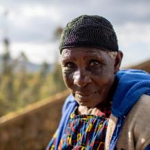 Oncology patient at Butaro District Hospital